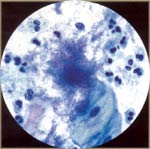 Actinomyces