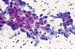 Cytologic features of various types of breast lesions as seen in FNA specimens