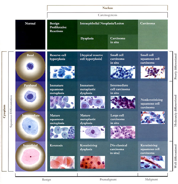 Pap Smear Abnormal Result