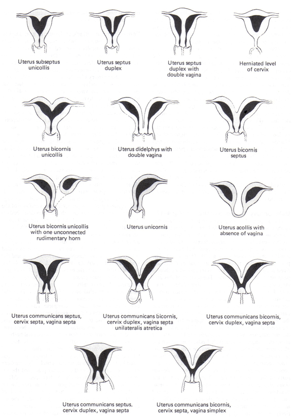 Figura 1. Anomalas congnitas del tero