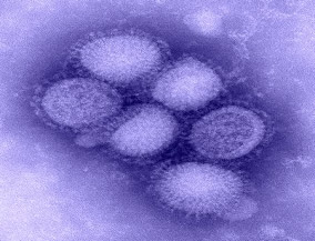 Negative-taché microscopie électronique en transmission de décrire certains des morphologie ultra-structurale de la grippe porcine A/CA/4/09 (H1N1).