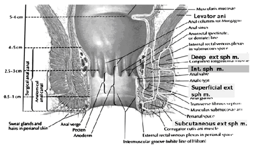 هذا تخطيطي يبين أن الشرج العاصرة العضلة العاصرة الخارجية وتتكون من تحت الجلد ، وسطحية ، وجزء عميق. <br>ومن المعتقد أن العميق الشرج العاصرة العضلة العاصرة الخارجية هو في الواقع puborectalis العضلات.