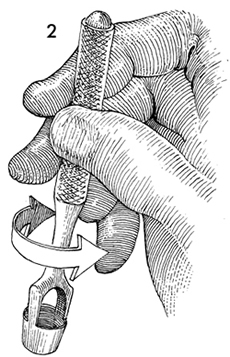 Figure 5 skin biopsy instrument