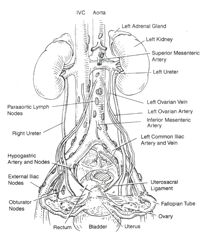 Histology of Ovarian Cancer