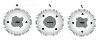 Diagram Direct Cervical Injection Sites