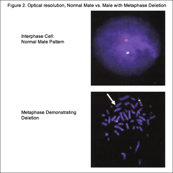 Figure 2. Optical Resolution, Normal Male vs. Male with Metaphase Deletion