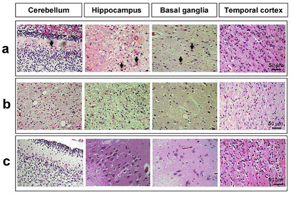 Figure 7. neuronal-astrocyte-vascular parameters in four brain regions