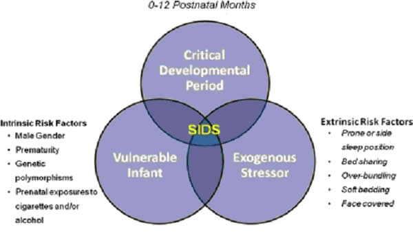 Sids Risk By Month Chart 2017