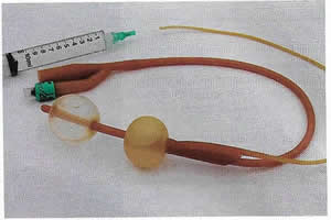 fig3_trettner_catheter300x200.jpg